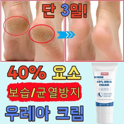 [강보습] 발각질제거 크림 뒷꿈치 유리아 요소 크림 발 갈라짐 인텐스 모이스처 크림 발 갈라짐 방지 고농도 요소 풋크림, 6개